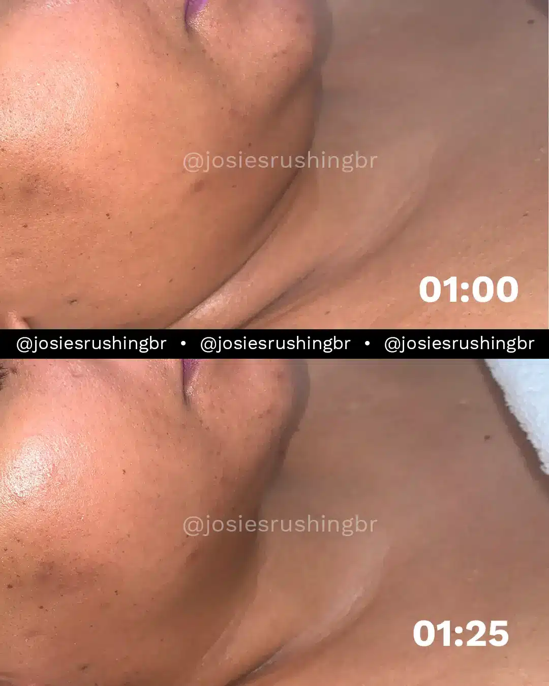 Facial 1