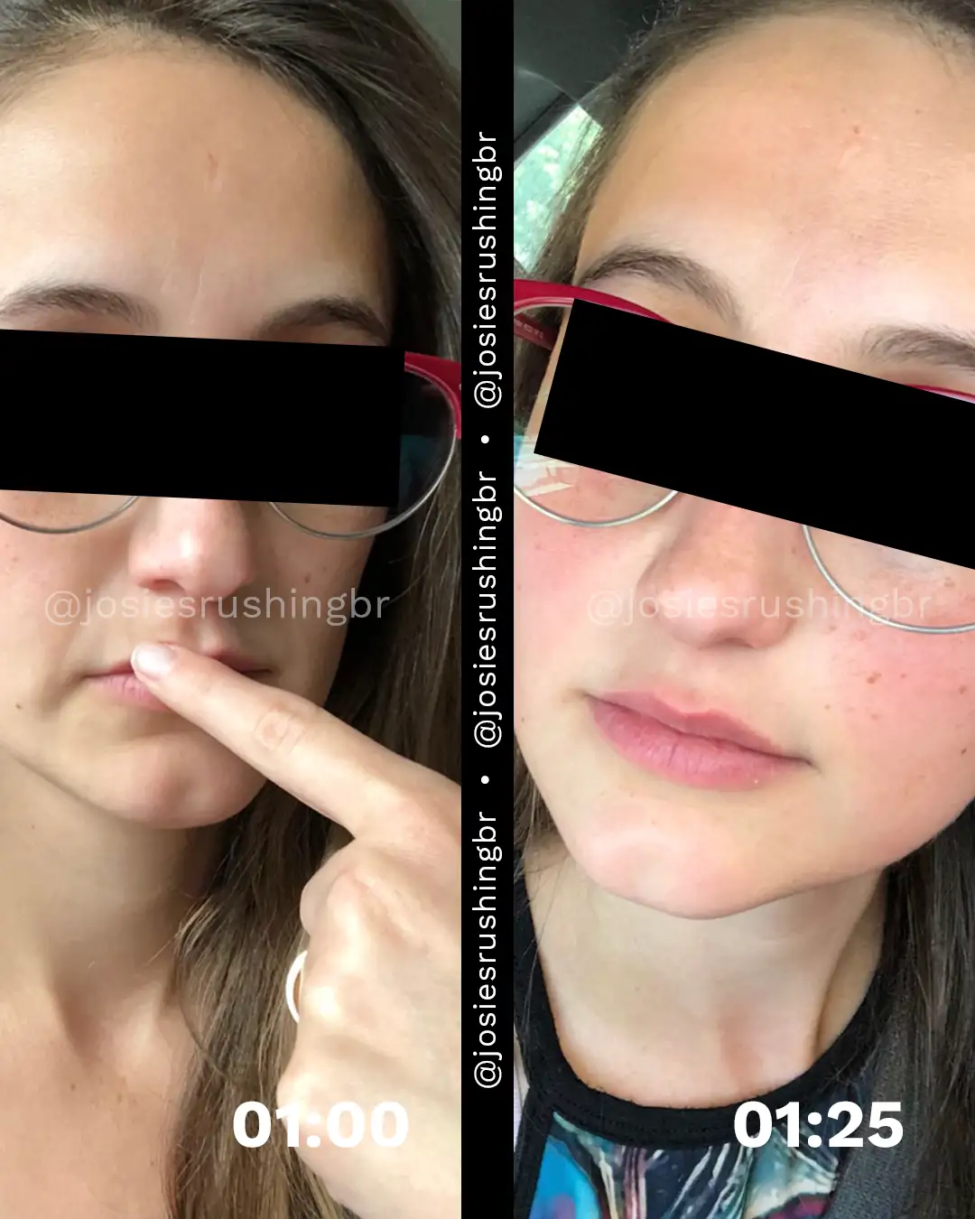 Facial 2