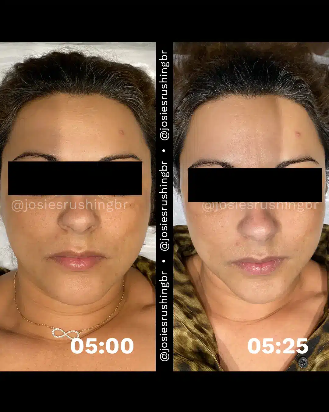 Facial 3