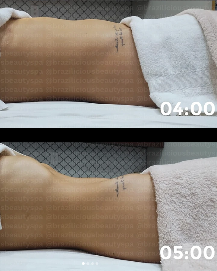 Before-After-1
