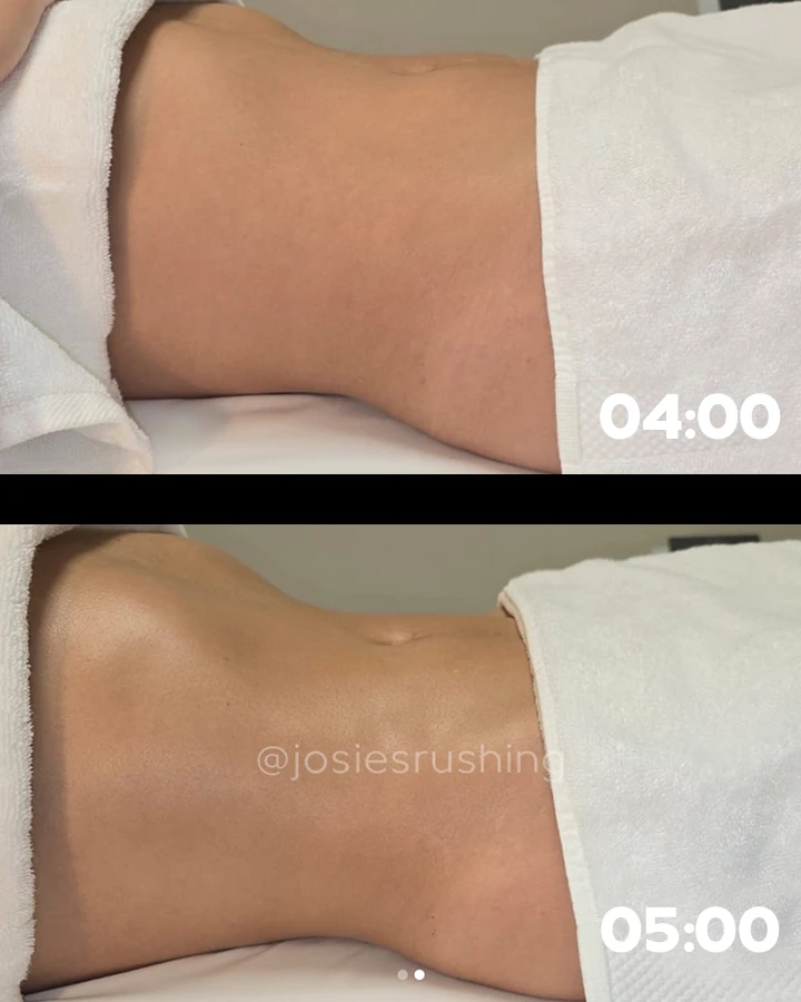 Before-After-10