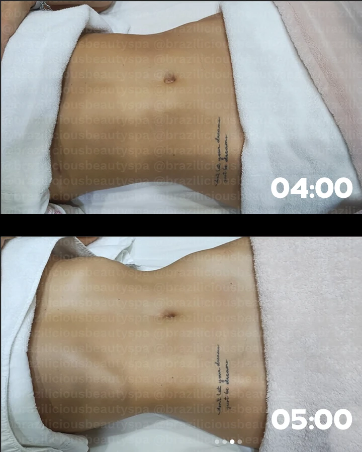 Before-After-4