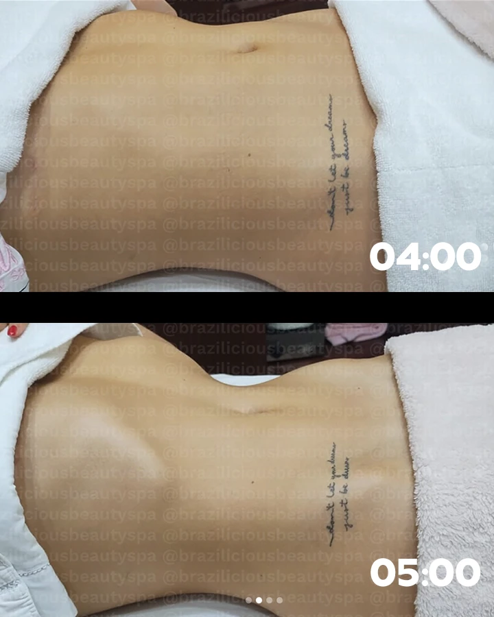 Before-After-5