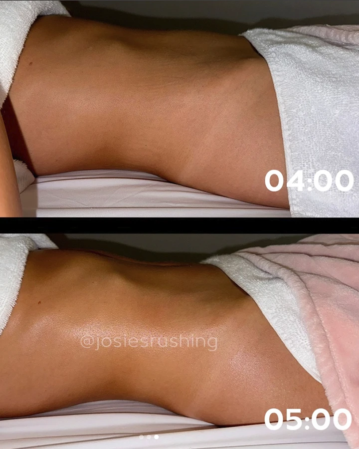 Before-After-6