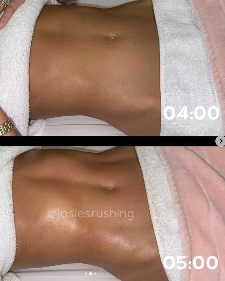 Before-After-7