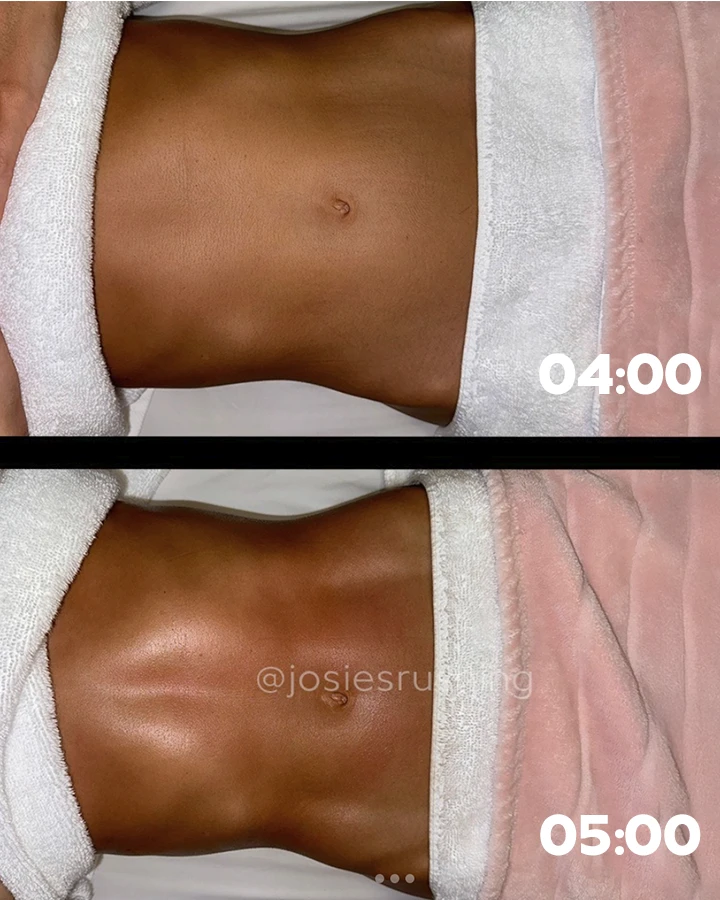 Before-After-8